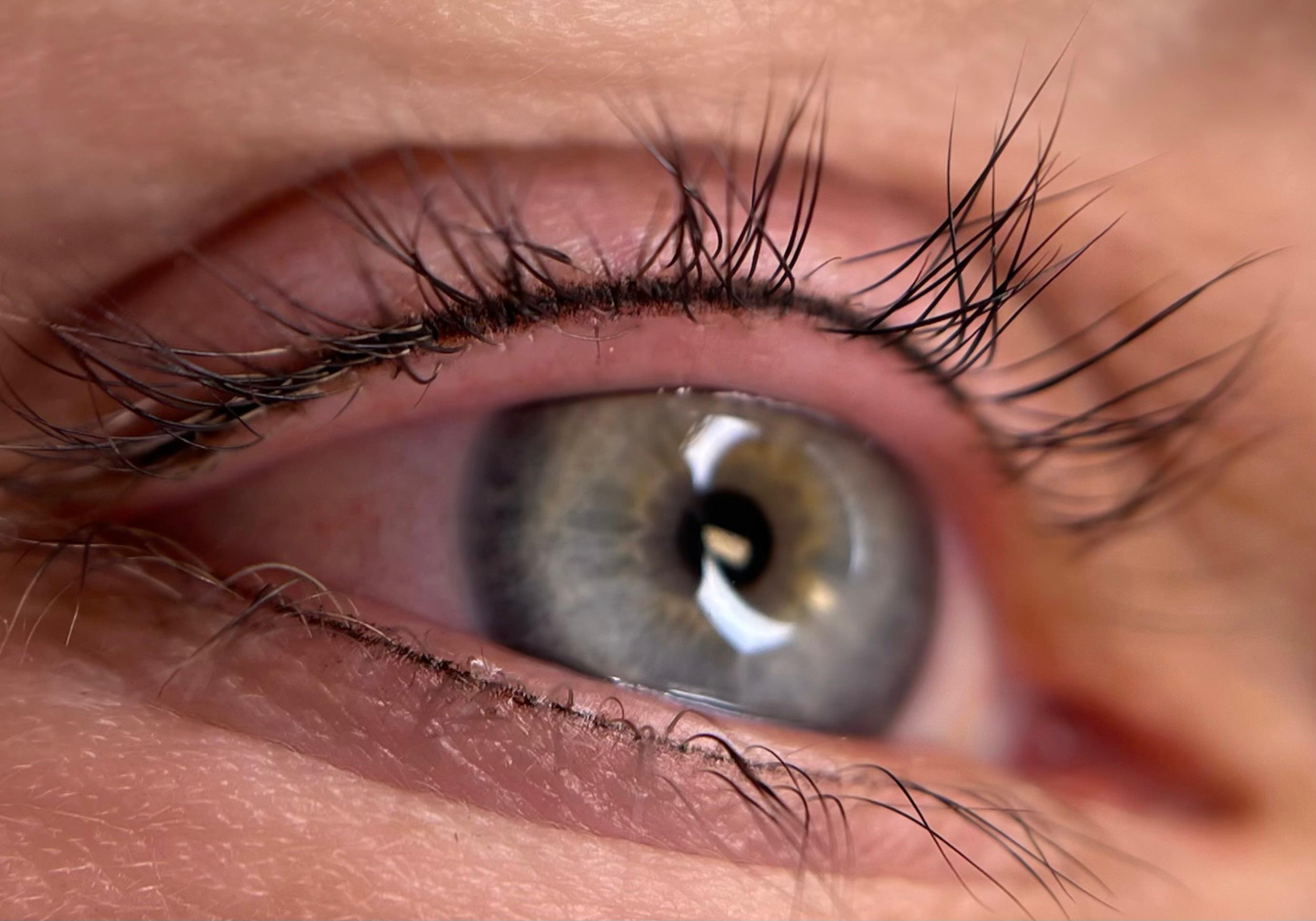 Deepliner onder behandeling